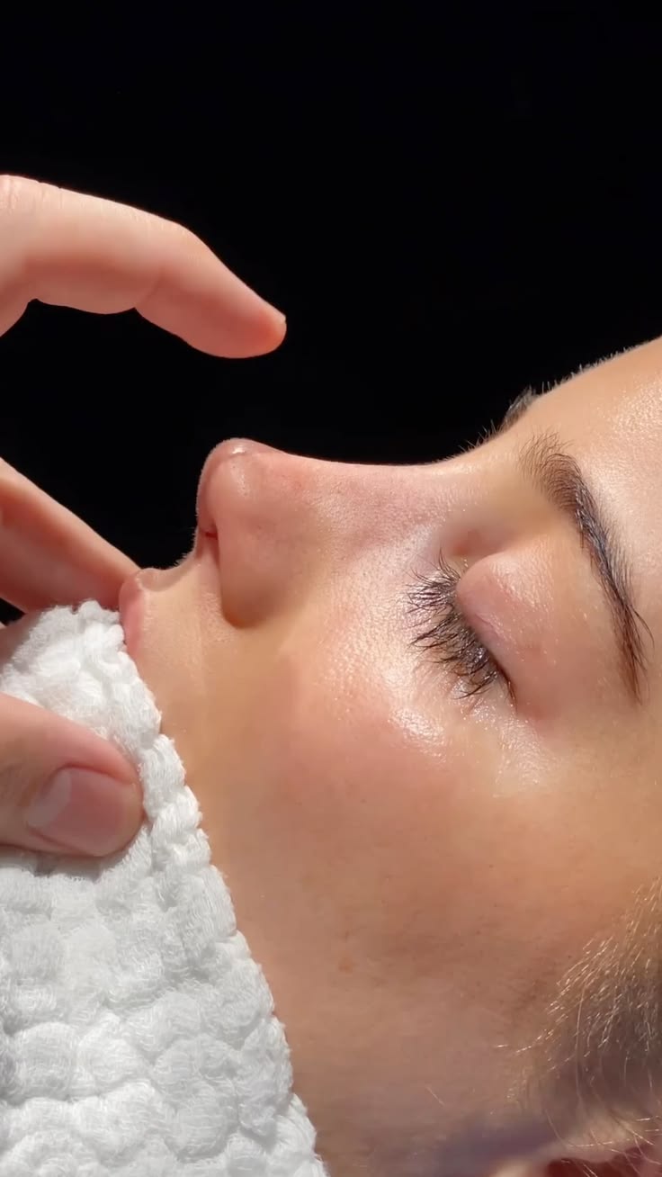 Rinoplastia